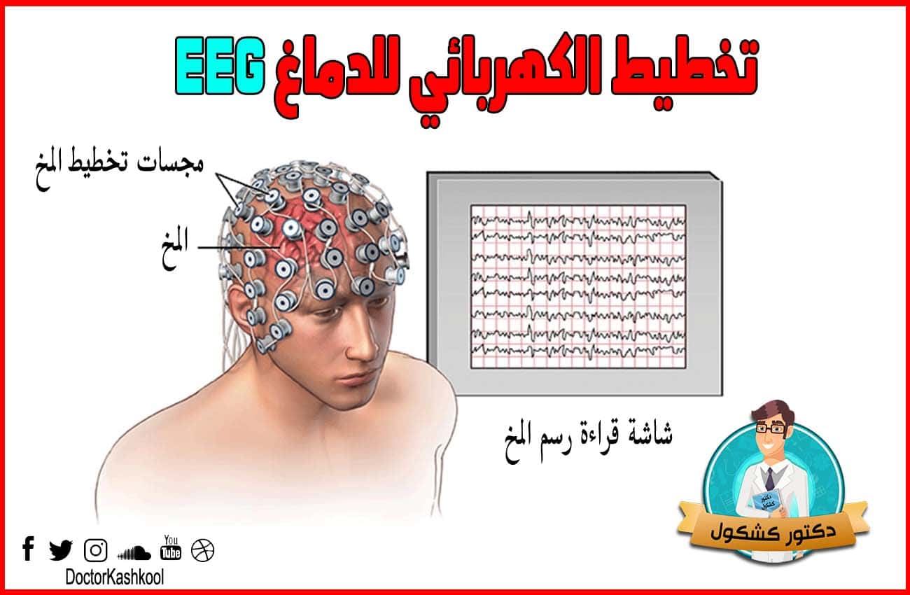تخطيط الكهربائي للدماغ EEG