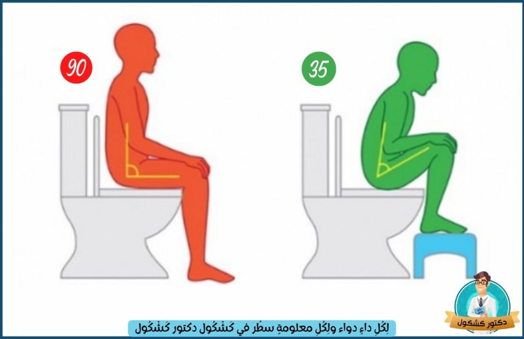 مقارنة بين الشكل الخاطئ والصحيح للجلوس على المرحاض