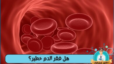 هل فقر الدم خطير؟