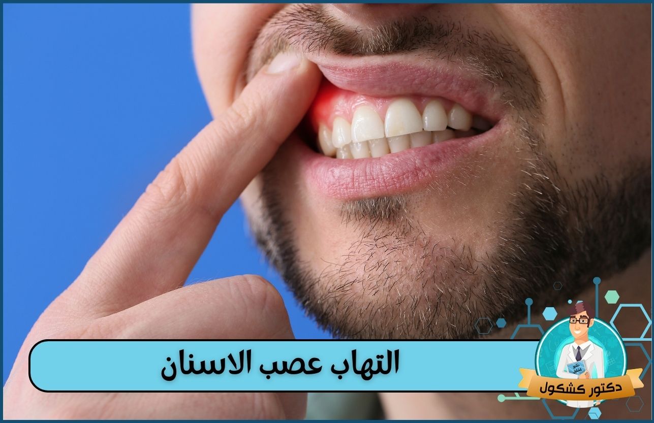 التهاب عصب الاسنان